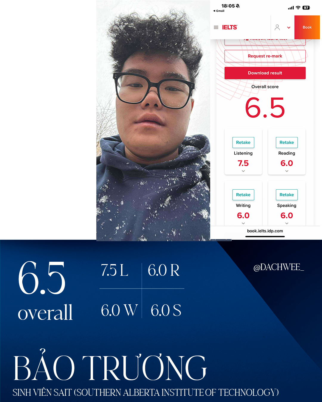 Bảo Trương — IELTS 6.5 Overall